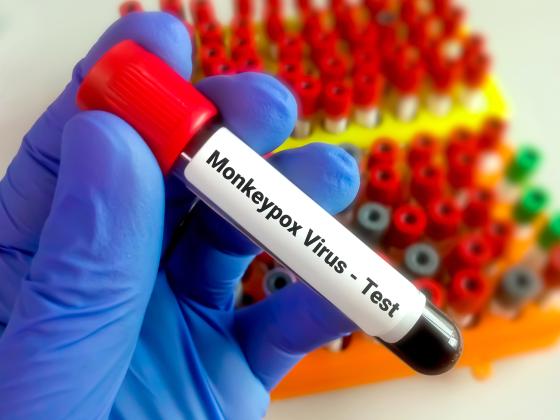 Check the availablity of monkeypox vaccines through the Osceola County Health Department at osceola.floridahealth.gov. PHOTO/METRO
