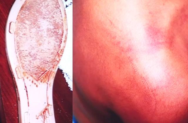 The Sheriff's Office presented pictures of a bloody sandal, and injuries sustained by one of the children Wednesday. PHOTO/SHERIFF'S OFFICE